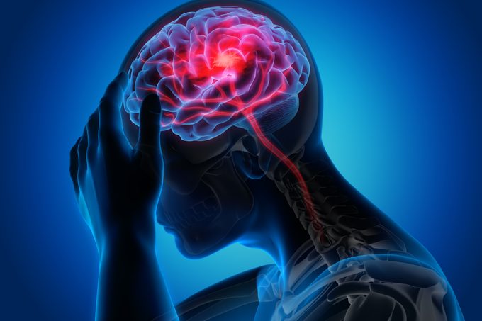 This Is the “Most Effective Way” to Prevent Stroke Death, Expert Doctor Says