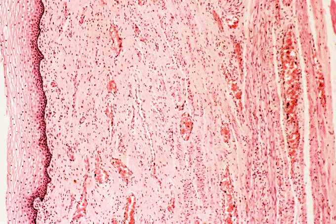 What Is Vaginitis? Women’s Doctors Explain